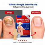 MicoDerm Parche Antifúngico para Hongos